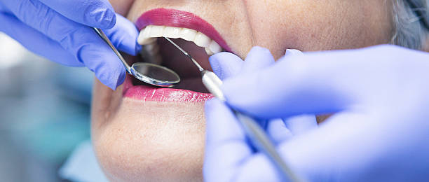Best Emergency Root Canal Treatment in Mystic, CT